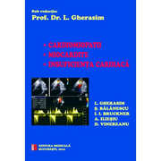 Cardiomiopatii - Miocardite - Insuficienta cardiaca