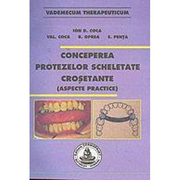 Conceperea protezelor scheletate crosetante