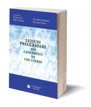 Leziuni precursoare ale cancerului de col uterin - Nicolae Gica, Ana Maria Panaitescu, Radu Botezatu, Gheorghe Peltecu