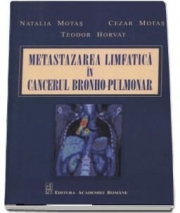 Metastazarea limfatica in cancerul bronho-pulmonar - Natalia Motas - Editura Academiei Romane