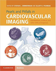 Pearls and Pitfalls in Cardiovascular Imaging: Pseudolesions, Artifacts, and Other Difficult Diagnoses - Stefan L. Zimmerman, Elliot K. Fishman