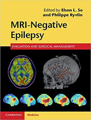 MRI-Negative Epilepsy: Evaluation and Surgical Management - Elson L. So, Philippe Ryvlin