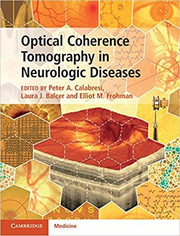 Optical Coherence Tomography in Neurologic Diseases - Peter A. Calabresi, Laura J. Balcer, Elliot M. Frohman