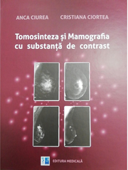Tomosinteza si Mamografia cu substanta de contrast - Anca Ciurea, Cristiana Ciortea