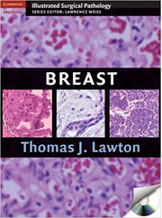 Breast - Thomas J. Lawton MD