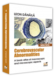 Cerebrovascular abnormalities. A book-atlas of macroscopic and microscopic aspects - Leon Danaila