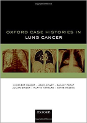 Oxford Case Histories in Lung Cancer - Himender K. Makker, Adam Ainley, Sanjay Popat, Julian Singer, Martin Hayward, Antke Hagena