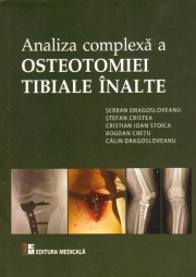 Analiza complexă a osteotomiei tibiale înalte