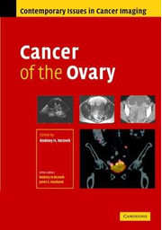 Cancer of the Ovary - Rodney Reznek