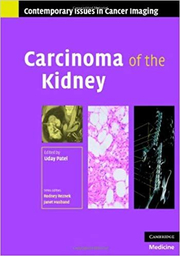 Carcinoma of the Kidney - Uday Patel