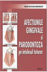Afectiunile gingivale si paradontoza pe intelesul tuturor - Nouri Davijani Mahnoush