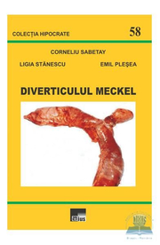 Diverticulul Meckel - Corneliu Sabetay, Ligia Stanescu, Emil Plesea
