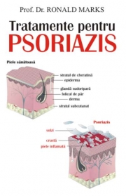 Tratamente pentru psoriazis - Prof. dr. Ronald Marks